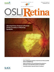 眼科手术、激光和视网膜成像